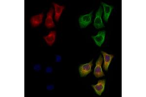 ABIN7094718 and ABIN7098769 staining Hela cells by IF/ICC. (DPP6 抗体  (Catalytic Domain, Internal Region))