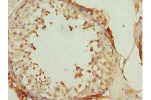 Immunohistochemistry of paraffin-embedded human testis tissue using ABIN7150764 at dilution of 1:100 (DUSP22 抗体  (AA 1-184))