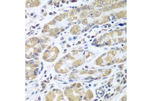 Immunohistochemistry of paraffin-embedded human stomach using EIF1AX antibody (ABIN5973507) at dilution of 1/100 (40x lens). (EIF1AX 抗体)