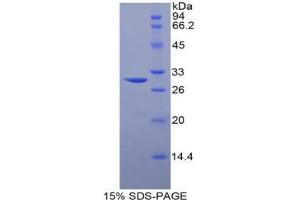 SDS-PAGE analysis of Human Sphingosine Kinase 1 Protein. (SPHK1 蛋白)