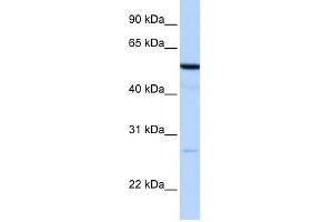 REEP4 antibody used at 1 ug/ml to detect target protein. (Receptor Accessory Protein 4 抗体  (N-Term))
