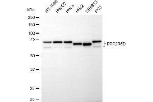 anti-Protein Phosphatase 2, Regulatory Subunit B', delta (PPP2R5D) antibody