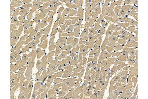 ABIN7096925 and ABIN7100991 at 1/100 staining rat heart tissue by IHC-P. (CLN8 抗体)