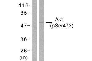 Western Blotting (WB) image for anti-V-Akt Murine Thymoma Viral Oncogene Homolog 1 (AKT1) (pSer473) antibody (ABIN1847446) (AKT1 抗体  (pSer473))