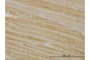 Immunoperoxidase of monoclonal antibody to PHKG1 on formalin-fixed paraffin-embedded human skeletal muscle. (PHKG1 抗体  (AA 1-387))