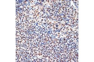 Immunohistochemistry (IHC) image for anti-Acidic (Leucine-Rich) Nuclear phosphoprotein 32 Family, Member B (ANP32B) antibody (ABIN7265377)