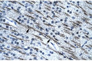 Immunohistochemistry (IHC) image for anti-Single-Stranded DNA Binding Protein 2 (SSBP2) (N-Term) antibody (ABIN2777444)
