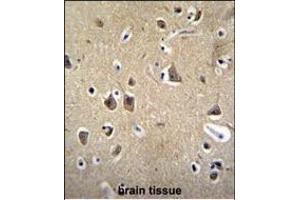 anti-Fatty Acid Desaturase Domain Family, Member 6 (FADS6) (AA 303-332), (C-Term) antibody