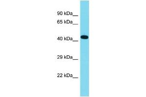 Host: Rabbit Target Name: C16orf91 Sample Type: Fetal Lung lysates Antibody Dilution: 1. (CCSMST1 抗体  (C-Term))