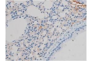 ABIN6267410 at 1/200 staining Mouse lung tissue sections by IHC-P. (Connexin 43/GJA1 抗体  (pSer368))