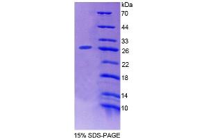 SDS-PAGE (SDS) image for Ecto-NOX Disulfide-Thiol Exchanger 2 (ENOX2) (AA 1-207) protein (His tag) (ABIN6239100) (ENOX2 Protein (AA 1-207) (His tag))