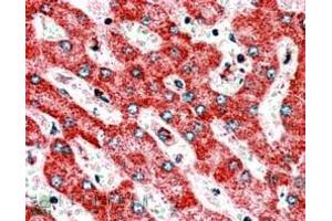 Image no. 2 for anti-ClpP Caseinolytic Peptidase, ATP-Dependent, Proteolytic Subunit Homolog (E. Coli) (CLPP) (C-Term) antibody (ABIN184946)