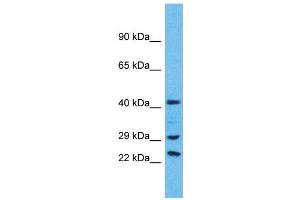 Western Blotting (WB) image for anti-Ubiquitin Specific Peptidase 41 (USP41) (C-Term) antibody (ABIN2791978) (USP41 抗体  (C-Term))