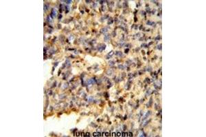 Immunohistochemistry (IHC) image for anti-Fc Fragment of IgG, Low Affinity IIc, Receptor For (CD32) (FCGR2C) antibody (ABIN3003995) (FCGR2C 抗体)