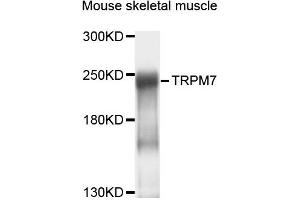 Western blot analysis of extracts of mouse skeletal muscle cells, using TRPM7 antibody. (TRPM7 抗体)