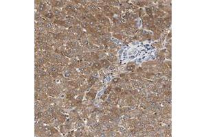 Immunohistochemical staining of human lymph node with C3orf52 polyclonal antibody  shows strong cytoplasmic positivity in reaction center cells at 1:200-1:500 dilution.