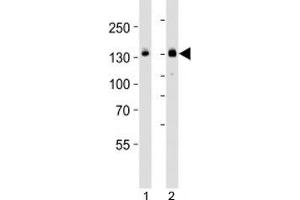 Western blot analysis of lysate from HT-29 cell line and mouse spleen tissue lysate (left to right) using JAK1 antibody; Ab was diluted at 1:1000 for each lane. (JAK1 抗体  (C-Term))