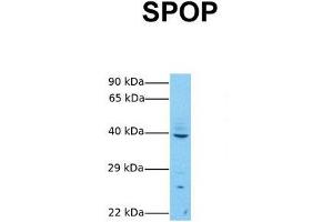 Host:  Rabbit  Target Name:  SPOP  Sample Tissue:  Human MCF7  Antibody Dilution:  1. (SPOP-B 抗体  (C-Term))