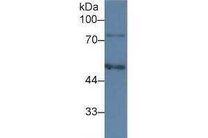 Western Blot; Sample: Human HepG2 cell lysate; Primary Ab: 3µg/ml Mouse Anti-Human C1INH Antibody Second Ab: 0. (SERPING1 抗体  (AA 399-500))