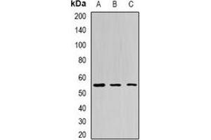 Western blot analysis of BPI expression in Jurkat (A), HepG2 (B), mouse liver (C) whole cell lysates. (BPI 抗体)