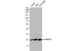 WB Image NDUFS3 antibody detects NDUFS3 protein by western blot analysis. (NDUFS3 抗体  (Center))