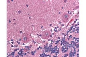 Anti-CCT2 antibody IHC of human brain, cerebellum. (CCT2 抗体)