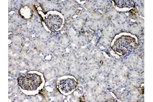 IHC analysis of Crp using anti- Crp antibody . (CRP 抗体  (AA 20-225))