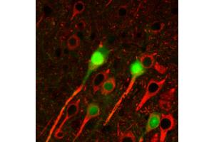 Immunohistochemistry staining of betaIII tubulin (red) in tissue sections of murine brain expressing GFP in some of its neurons (green). (TUBB3 抗体  (N-Term))