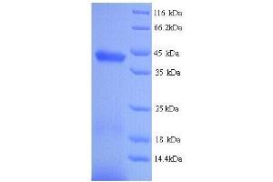 Pepsinogen C (PGC) (AA 17-388) protein (His tag)