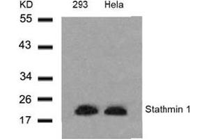 Image no. 3 for anti-Stathmin 1 (STMN1) (Ser24) antibody (ABIN197454) (Stathmin 1 抗体  (Ser24))
