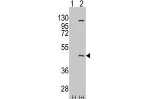 Western Blotting (WB) image for anti-Protein Arginine Methyltransferase 8 (PRMT8) antibody (ABIN2996585) (PRMT8 抗体)