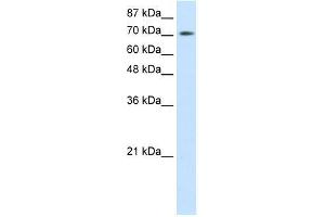 r-ZBTB48; WB Suggested Anti-ZBTB48 Antibody Titration: 0. (ZBTB48 抗体  (N-Term))
