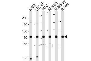 Western blot analysis of lysates from K562, LNCaP, PC-3 cell line, mouse brain, mouse kidney, rat liver tissue lysate (from left to right), using C Antibody (C-term) (ABIN6243097 and ABIN6577815). (CD164 抗体  (C-Term))