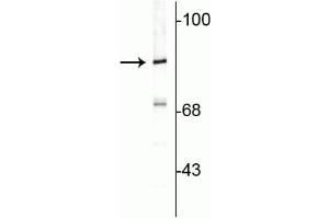 Western blot of rat cortical lysate showing specific immunolabeling of the ~82 kDa rabphilin 3A. (RPH3A 抗体  (C-Term))