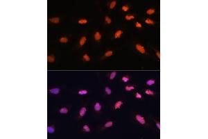 Immunofluorescence analysis of U-2 OS cells using BA antibody (ABIN7265937) at dilution of 1:100. (BAZ2A 抗体)