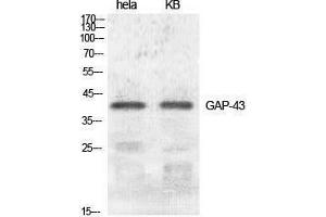 Western Blotting (WB) image for anti-Growth Associated Protein 43 (GAP43) (Ser421) antibody (ABIN3184740) (GAP43 抗体  (Ser421))