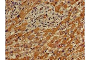Immunohistochemistry (IHC) image for anti-Apolipoprotein B mRNA Editing Enzyme, Catalytic Polypeptide-Like 4 (Putative) (APOBEC4) (AA 221-367) antibody (ABIN7166683)