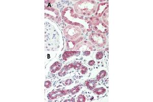 Immunohistochemical staining (Formalin-fixed paraffin-embedded sections) of human kidney (A) and human breast (B) with AVPR1A monoclonal antibody, clone 721CT25. (AVPR1A 抗体  (AA 353-383))