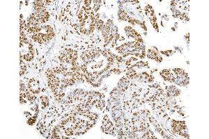 Immunohistochemistry (IHC) image for anti-SET Nuclear Oncogene (SET) (AA 125-175) antibody (ABIN7454812) (SET/TAF-I 抗体  (AA 125-175))