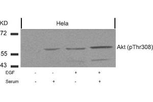 Western blot analysis of extracts from Hela cells untreated or treated with EGF, serum or both using Akt(Phospho-Thr308) Antibody.