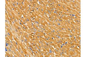 ABIN6259192 and ABIN6274507 at 1/100 staining Rat heart tissue by IHC-P. (SLK 抗体  (C-Term))