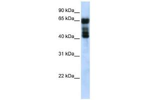 UGT2B4 antibody used at 1 ug/ml to detect target protein. (UGT2B4 抗体  (N-Term))
