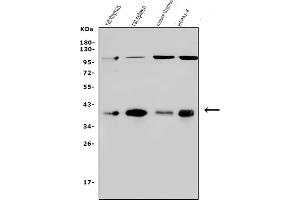 Western blot analysis of Mtnd2 using anti-Mtnd2 antibody (ABIN7603114).