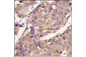 Image no. 2 for anti-Ubiquitin-Conjugating Enzyme E2L 6 (UBE2L6) (C-Term) antibody (ABIN357496) (UBE2L6 抗体  (C-Term))