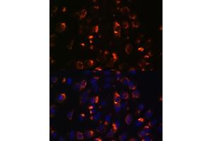 Immunofluorescence analysis of C6 cells using CCDC47 antibody (ABIN7266438) at dilution of 1:100. (CCDC47 抗体  (AA 224-483))