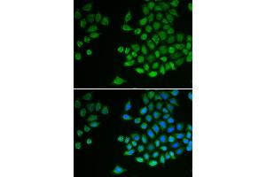 Immunofluorescence analysis of MCF-7 cells using PTPN2 antibody (ABIN5970915). (PTPN2 抗体)