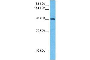 Host:  Rabbit  Target Name:  SAFB  Sample Tissue:  Human THP-1 Whole Cell lysates  Antibody Dilution:  1ug/ml (SAFB 抗体  (N-Term))