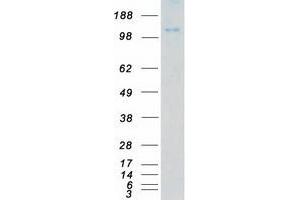 Western Blotting (WB) image for PTK2B Protein tyrosine Kinase 2 beta (PTK2B) (Transcript Variant 1) protein (Myc-DYKDDDDK Tag) (ABIN2720716)