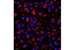 Immunofluorescence of paraffin embedded mouse brain using rasgrf1 (ABIN7073422) at dilution of 1:2000 (400x lens) (Cdc25 抗体)