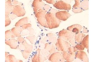 DAB staining on IHC-P; Samples: Mouse Skeletal muscle Tissue (MID1 抗体  (AA 1-212))
